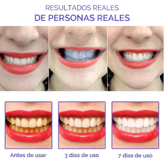 Smile Kit Advertorial - 15